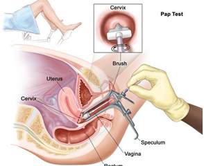 PAP smear test